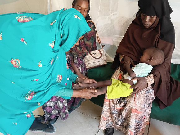 Sudan - thabat project - oedema check in Mornei Sc.